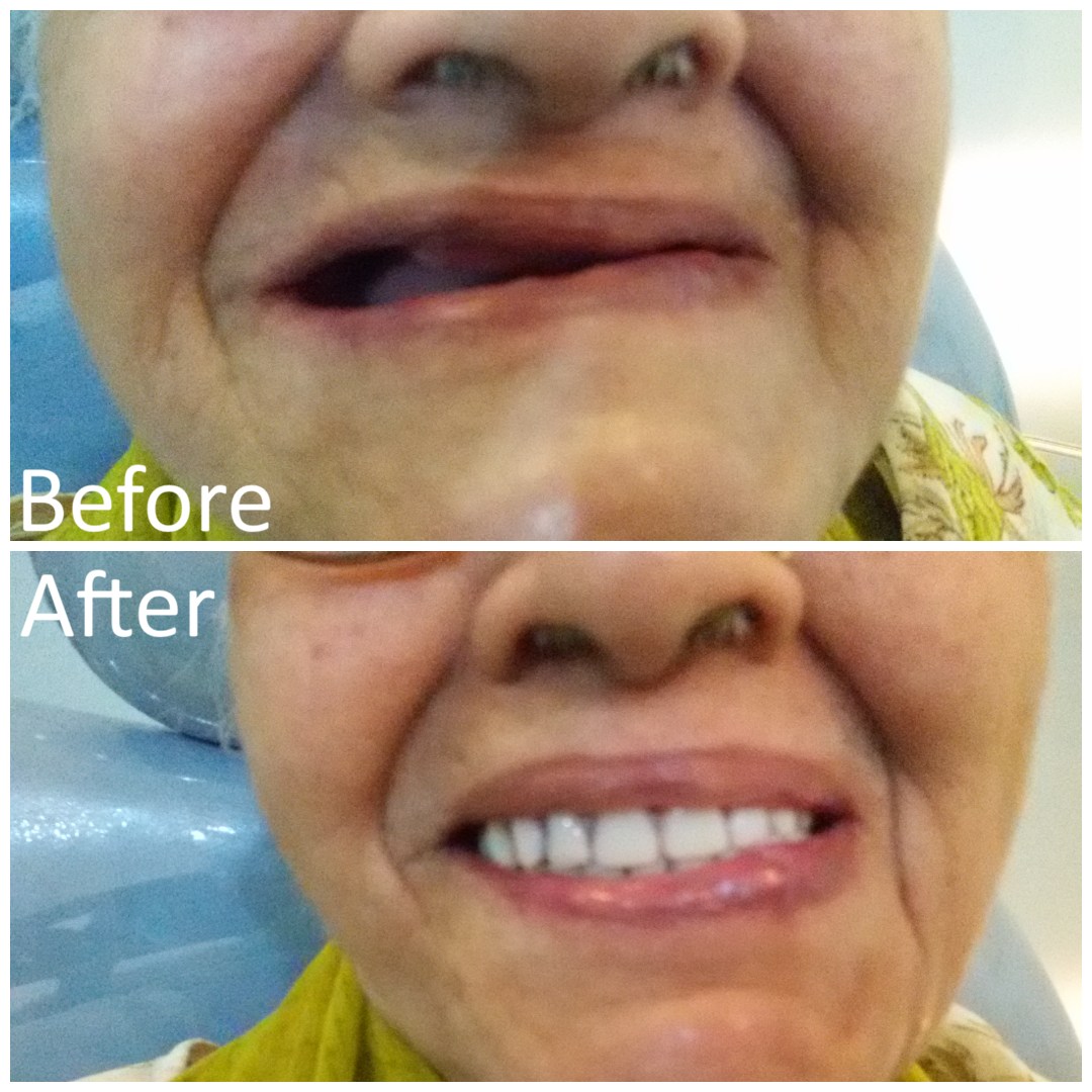 Dental Samagra media